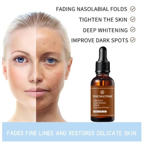 Youngcome Crocodile Scar Removal Serum In Pakistan
